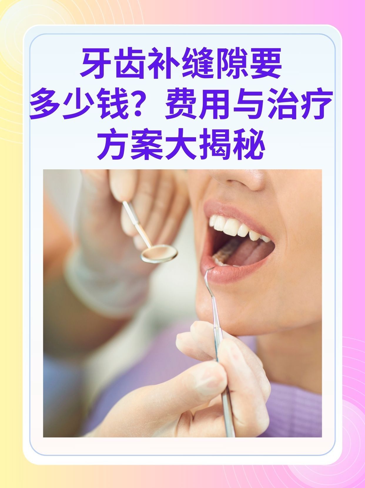 延安补牙医保可以报销吗(补牙医保可以报销吗 哪些可以报销呢)